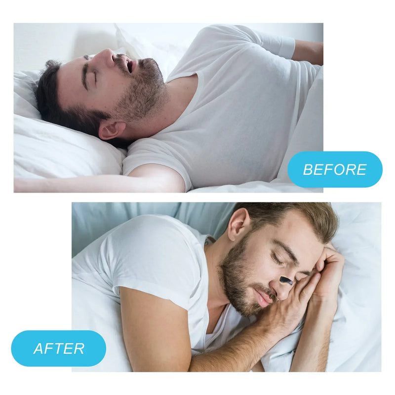 30-Day Nasal Breathing Dilators Kit – Magnetic Nose Strips for Sports, Sleep, and Snoring Relief