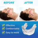 Anti Snoring Mouth Guard – Bruxism and Sleep Apnea Relief Mouthpiece for Better Sleep