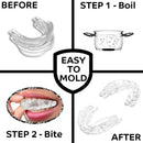 Anti Snoring Mouth Guard – Bruxism and Sleep Apnea Relief Mouthpiece for Better Sleep